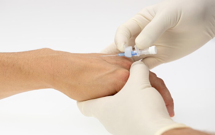 A nurse is planning to insert a peripheral iv catheter